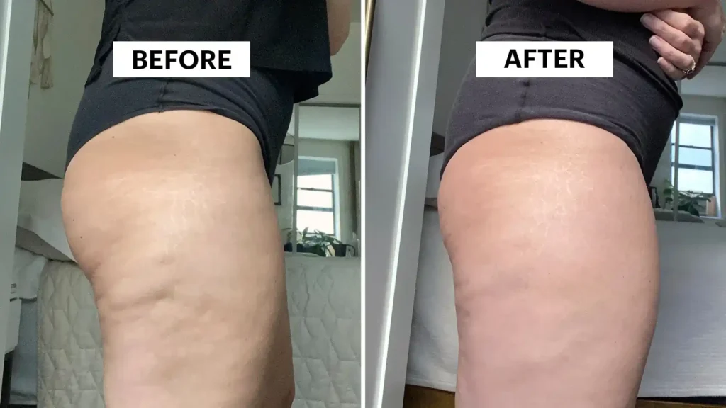 Do Toning Exercise Market Harborough Really Tackle Cellulite?